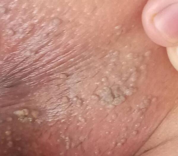 عکس جوش نی نی سایت