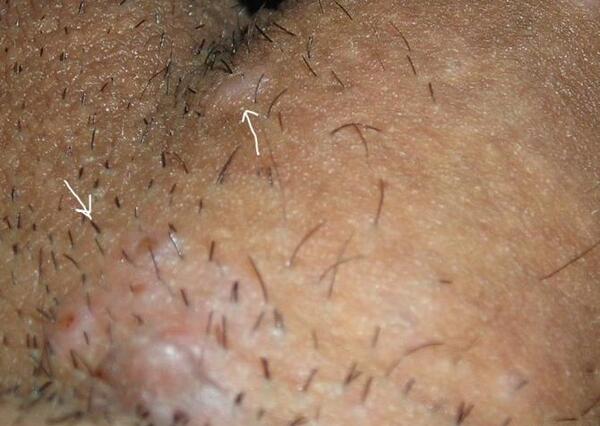 عکس جوش نی نی سایت