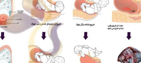عکس ترشحات نزدیک زایمان