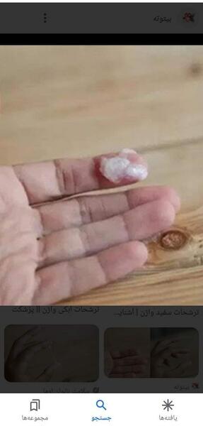 عکس ترشحات نزدیک زایمان