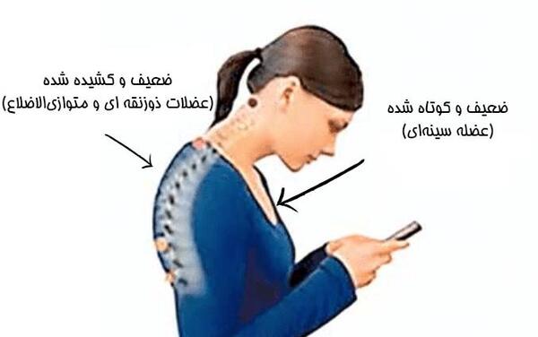 عکس عضله ذوزنقه