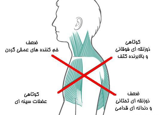 عکس عضله ذوزنقه