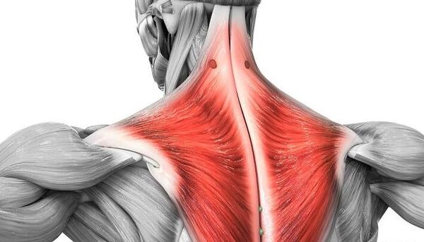 عکس عضله ذوزنقه