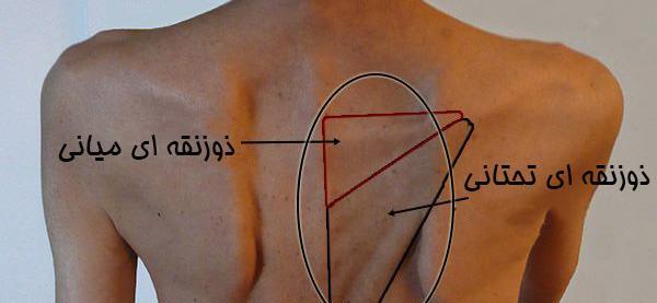 عکس عضله ذوزنقه