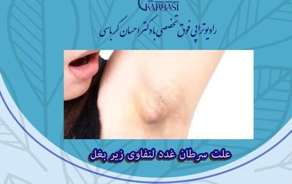 عکس زیر بغل طبیعی