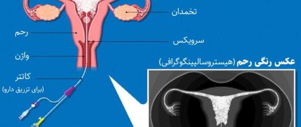 عکس در مورد ضرر سیگار