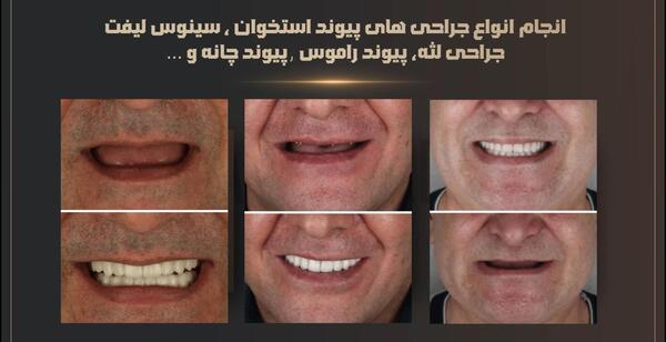 عکس قدیمی بین الحرمین با کیفیت