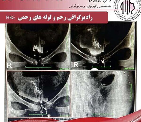 عوارض عکس رنگی رحم نی نی سایت
