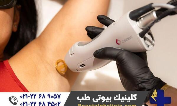 عکس دستگاه لیزر کندلا جنتل مکس پرو
