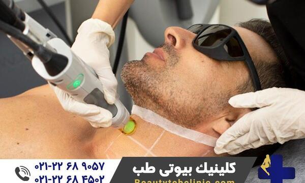 عکس دستگاه لیزر کندلا جنتل مکس پرو