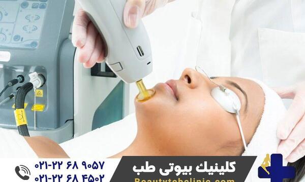 عکس دستگاه لیزر کندلا جنتل مکس پرو