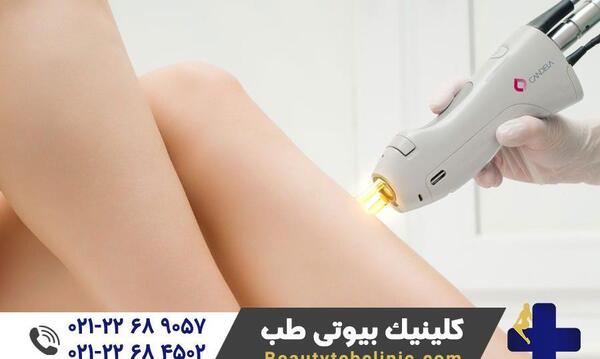 عکس دستگاه لیزر کندلا جنتل مکس پرو