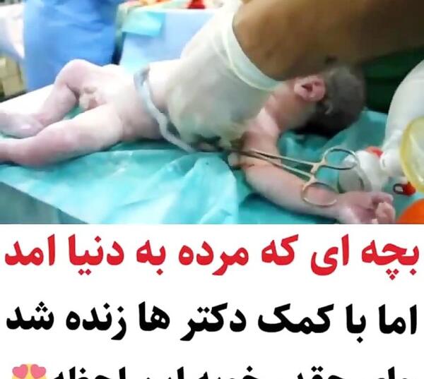 عکس نوزاد حین زایمان