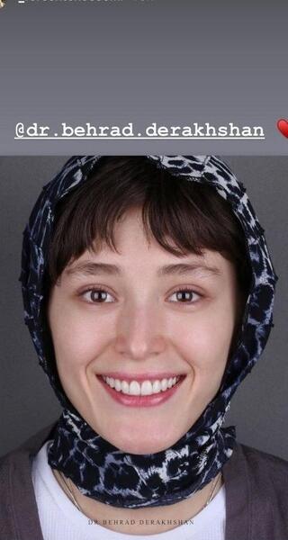 عکس فرشته حسینی قبل از عمل