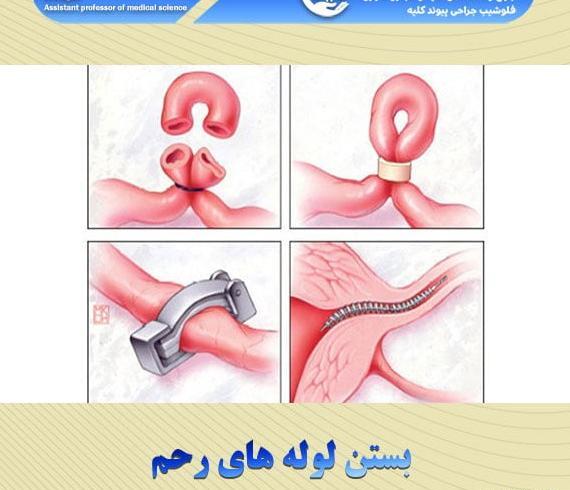 عکس هواپیما زمین گیر