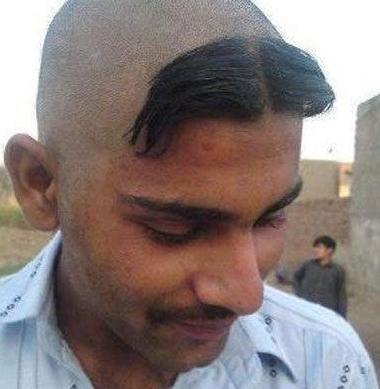 عکس پسر زشت سیاه
