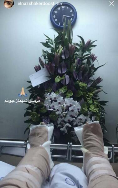 عکس فیک شکستن پا