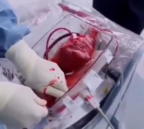 کلیپ عکس قلب شکسته