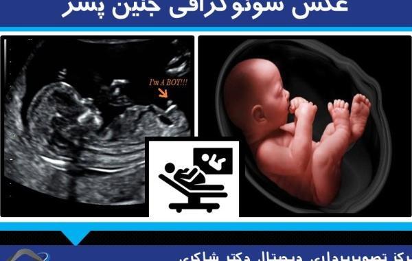 عکس واقعی جنین 20 هفته دختر