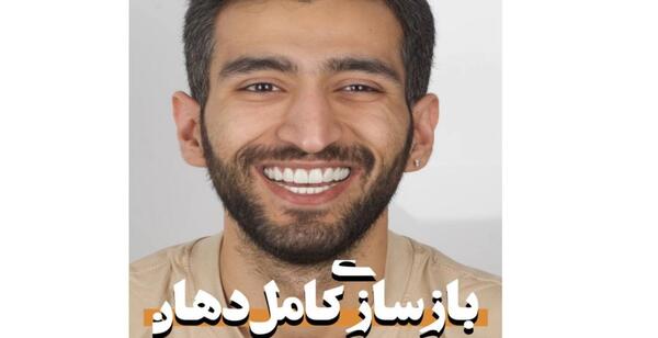 عکس تویوتا چوبی