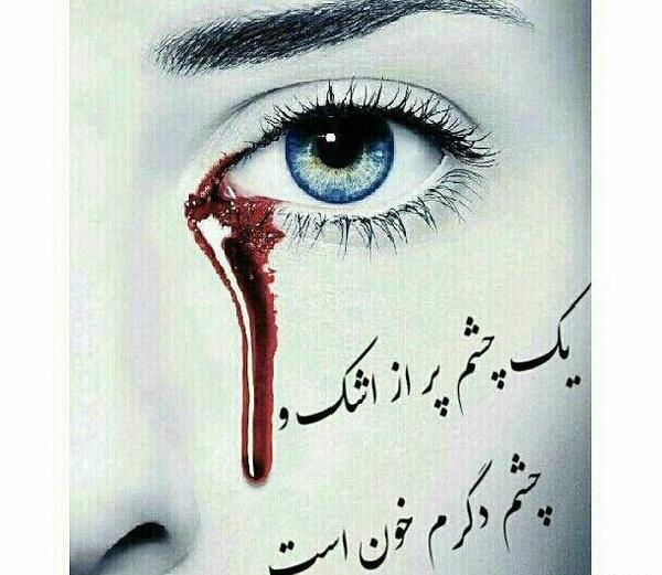 عکس پروفایل چشم پر از خون