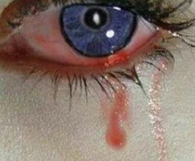 عکس پروفایل چشم پر از خون