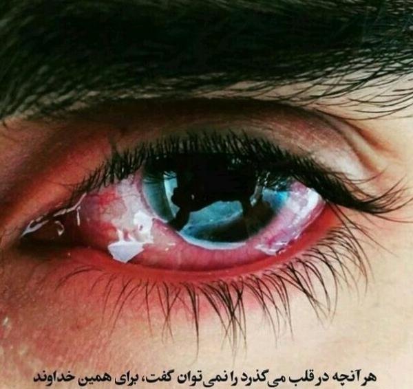 عکس پروفایل چشم پر از خون
