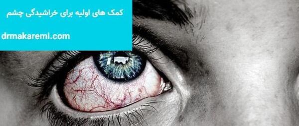 عکس پروفایل چشم زخمی