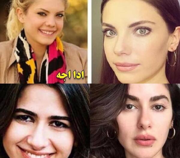 عکس پروفایل بچه گانه ست