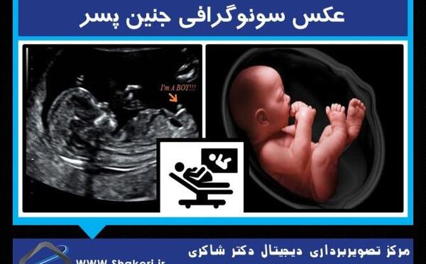 ژست عکس کودک ده ماهه