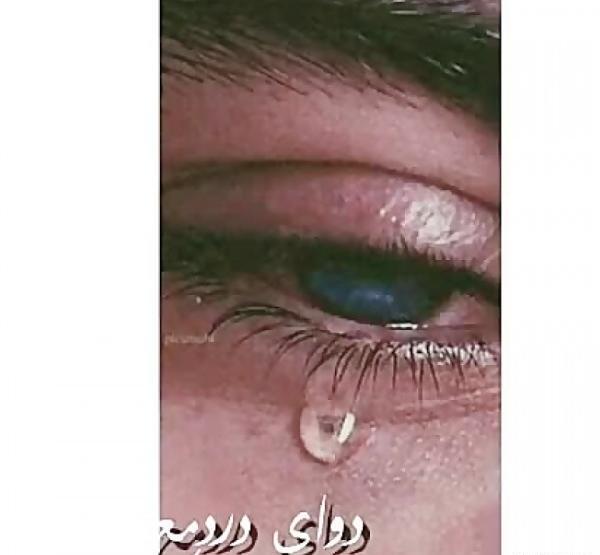 عکس پروفایل پسرانه چشم قرمز