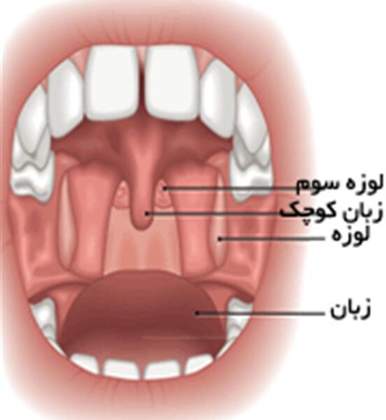 عکس لوزه