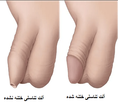 عکس چیز مرد واقعی