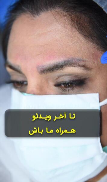 عکس زدن بن مژه