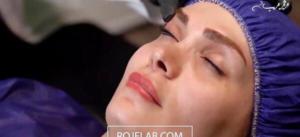 عکس زدن بن مژه