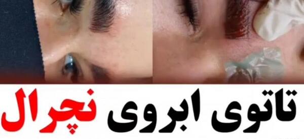 عکس زدن بن مژه