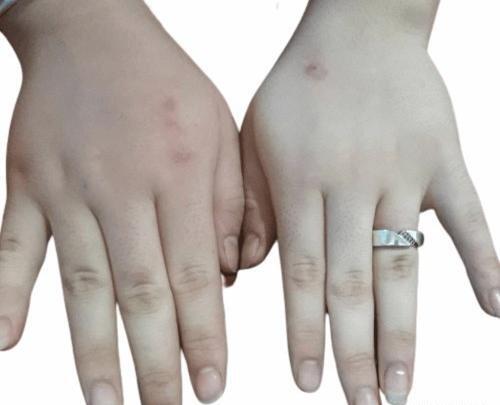 عکس ماسک سفید برفی