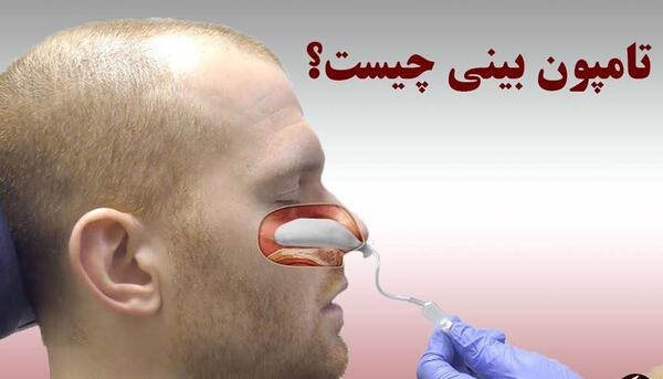 عکس تامپون
