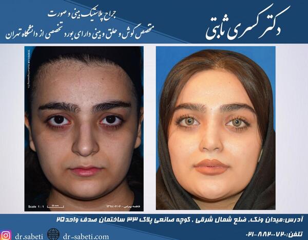عکس بینی پینوکیو