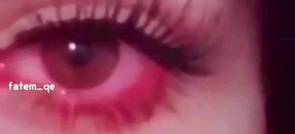 فیک دخترانه عکس گریه دختر طبیعی