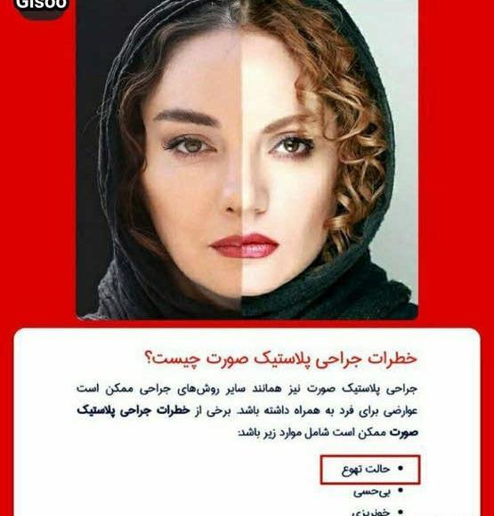 عکس گیسو در سریال گیسو