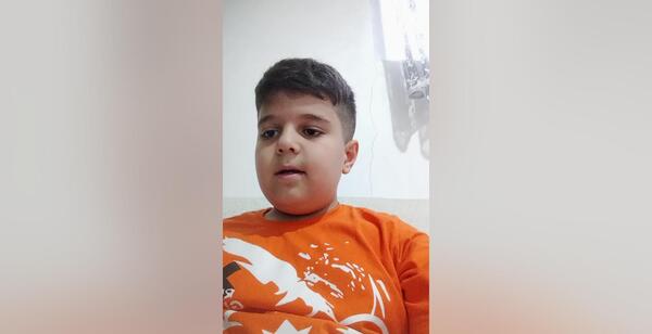 عکس بالم لب کیوت فانتزی