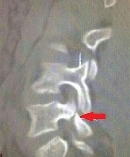 عکس نیمار چهره