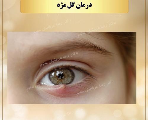 عکس گل مژه
