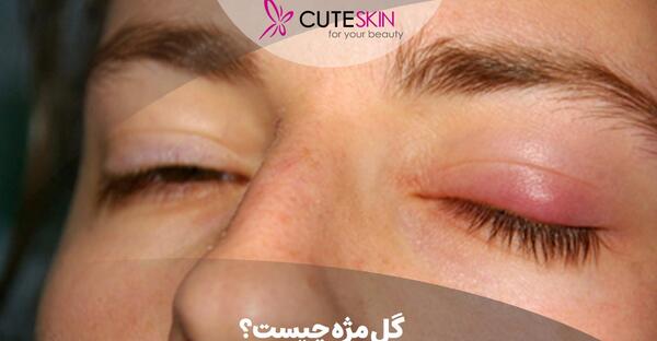 عکس گل مژه