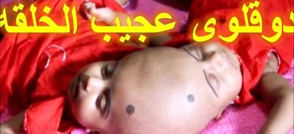 عکس نوزاد عجیب الخلقه در هند