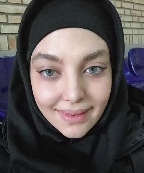 عکس دختر ۱۶ ساله زشت