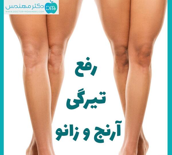عکس سیاهی آرنج و زانو
