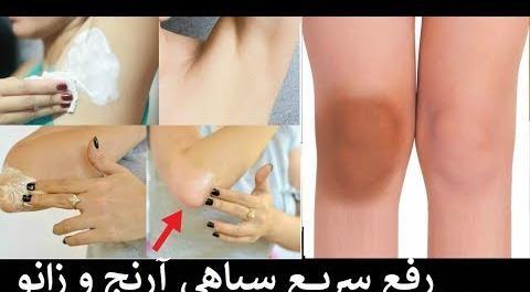 عکس سیاهی آرنج و زانو