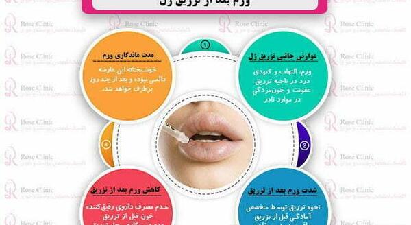 عکس ورم صورت بعد از تزریق ژل
